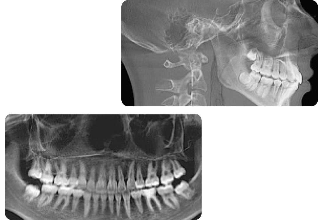 digital radiography