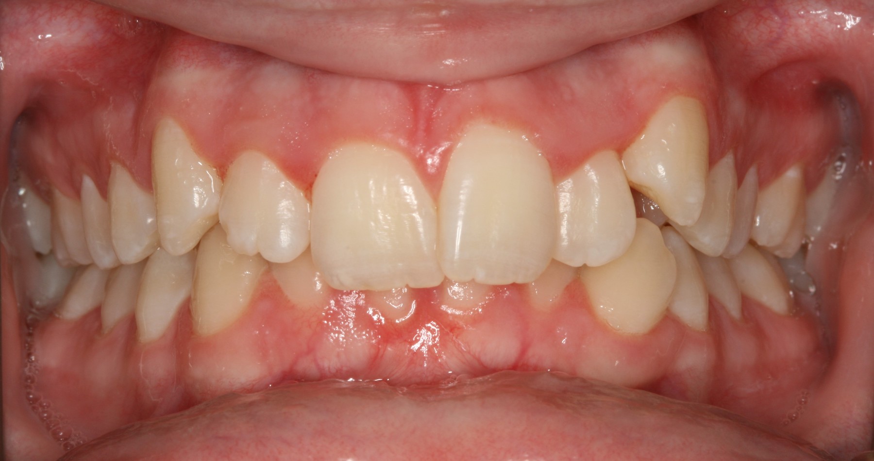 Patient Results – Oahu Orthodontics